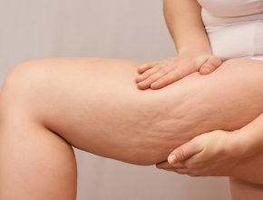 如何瘦大腿最快？避開迷思，科學方法與習慣一次掌握