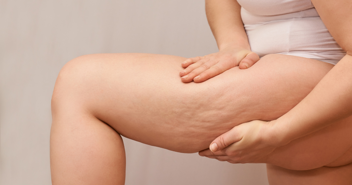 如何瘦大腿最快？避開迷思，科學方法與習慣一次掌握