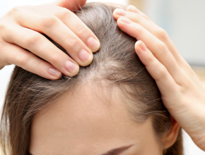 子宮太冷讓你提早掉髮?數據解析女性健康新關鍵 7 子宮太冷讓你提早掉髮?數據解析女性健康新關鍵