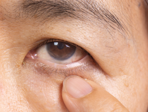 左右眼皮跳不停是吉兆還是警訊？男女時辰迷思與醫師解析的真正原因懶人包