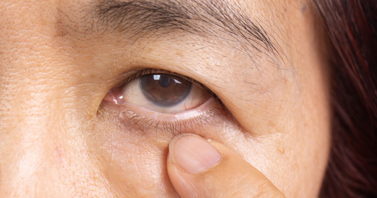 左右眼皮跳不停是吉兆還是警訊？男女時辰迷思與醫師解析的真正原因懶人包