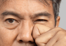 左右眼皮一直跳是怎麼回事？原因、徵兆與改善方式一次看懂