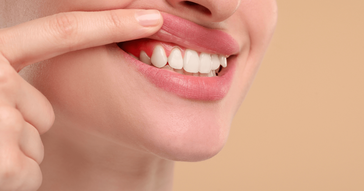 牙齦發炎怎麼辦？完整照護指南讓你快速改善口腔健康